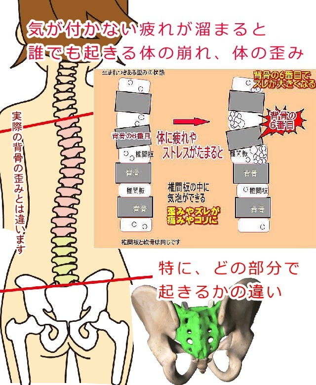 体の崩れ