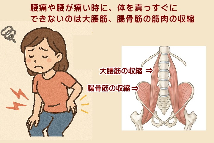 大腰筋、腸骨筋が収縮すると真っすぐに立ちにくくなる 北九州市小倉南区徳力整体院