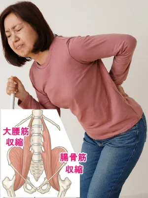 大腰筋、腸骨筋のバランスの崩れと筋肉の収縮