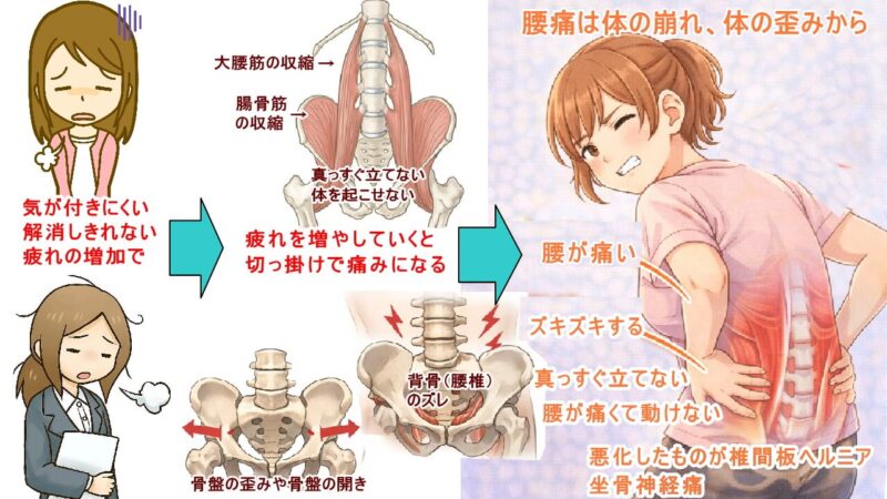 北九州市 小倉南区 腰痛 整体 徳力整体院