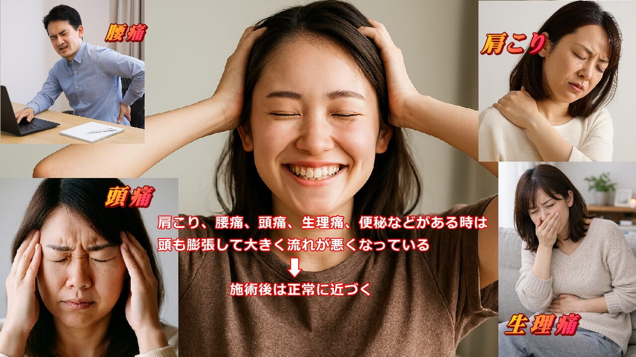 痛みやコリがある時は頭の流れも悪くなり、膨張しているので