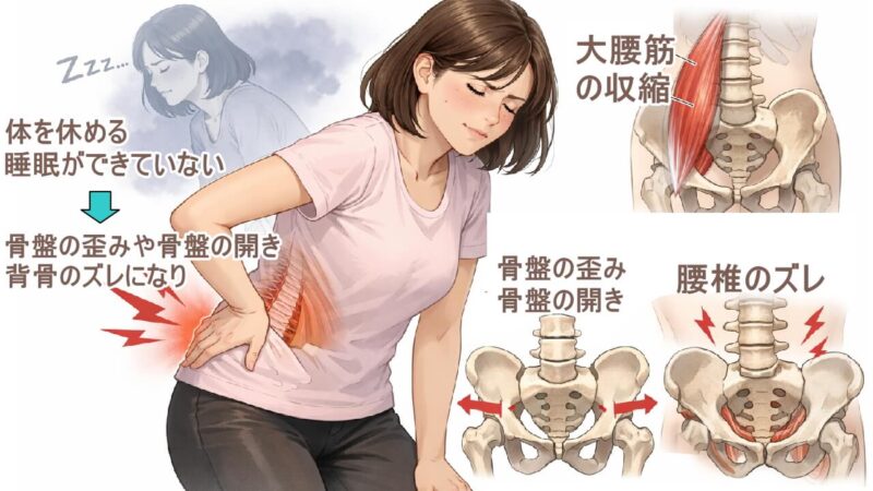 腰が痛くなるのは、骨盤の歪みや骨盤の開き、背骨のズレから