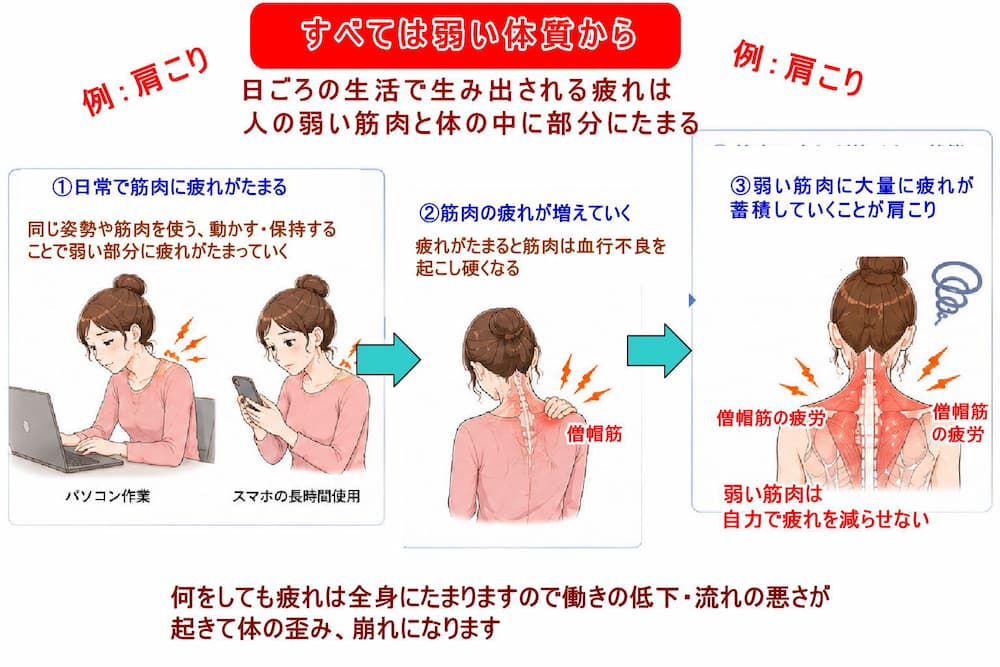 肩こりは筋肉のコリだけではなく体質的に弱い部分に疲れがたまる。北九州市・小倉の徳力整体院。