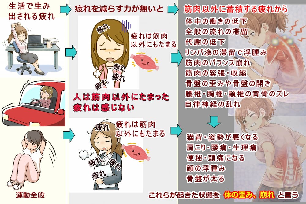解消しない疲れが体質的に弱い部分にたまる事で起きる体の歪み、崩れは。北九州市・小倉の徳力整体院。
